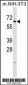 KLHL12 Antibody (C-term)